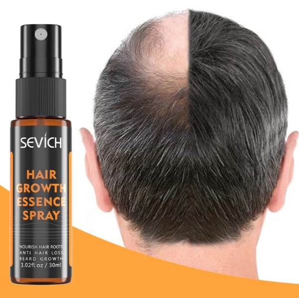 Picture of SEVICH Hair Growth Essence Spray - Natural Fragrance Free Hair Care for Men and Women, 30ml, Hair Loss & Thinning Prevention Treatment, Scalp Improver, Biotin for Healthy Hair-Multicolor