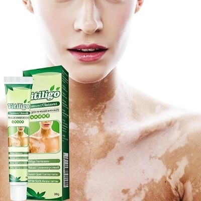 Picture of Vitiligo Treatment Cream Healthy White Spot Therapeutic Gel-Multicolor