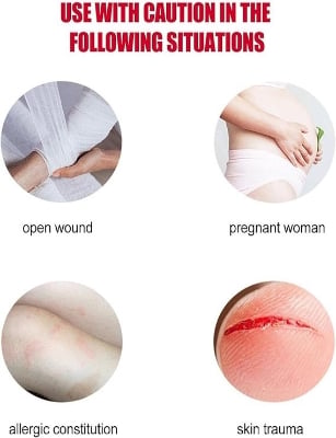 Picture of Vitiligo Treatment Cream Healthy White Spot Therapeutic Gel-Multicolor