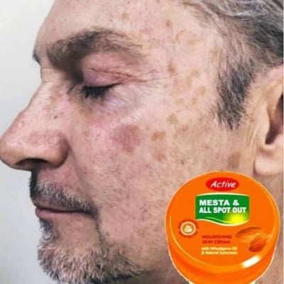 Picture of Active Mesta and All Spot Out Nourishing Skin Cream indian
