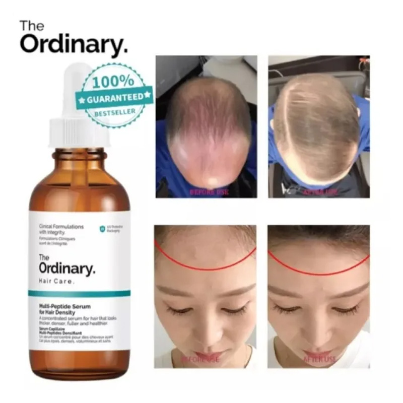 Picture of MultiPeptide Serum Hair Density 60ml