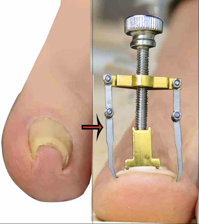 Picture of Manicure set manicure set for nail repair pedicure tool