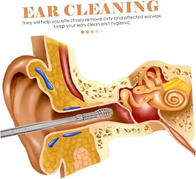 Picture of 6sets Earwax Removal Supplies Kit Includes Spoon Picker Massager and Storage Bag for Easy Cleaning The Go  