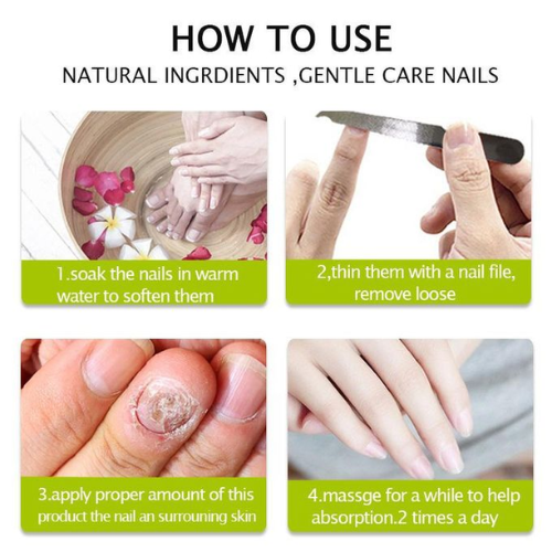 Picture of Efero Nail Cream Treatment Repair Gel Moisturizing And Luster-Nail & Cuticle Care-Nr mart - Multicolor
