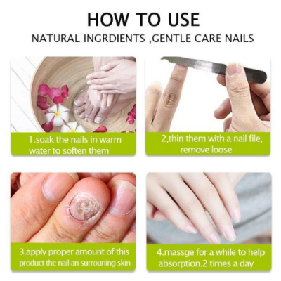Picture of Efero Nail Cream Treatment Repair Gel Moisturizing And Luster-Nail & Cuticle Care-Nr mart - Multicolor