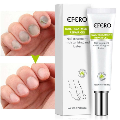 Picture of Efero Nail Cream Treatment Repair Gel Moisturizing And Luster-Nail & Cuticle Care-Nr mart - Multicolor