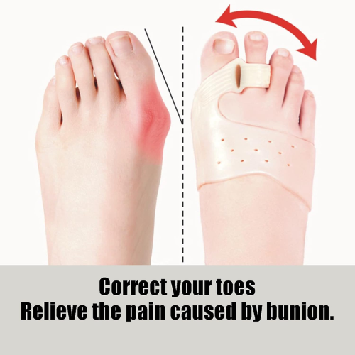 Picture of First use and then Pay Keliang Magnet Toe Corrector Thumb Valgus Big Toe Bone Can Wear Shoes for Men and Women-One Pair-Foot Relief Accessories & Tools-Nr mart - Multicolor