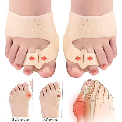 Picture of First Use and Then Pay Keliang Magnet Toe Corrector Thumb Valgus Big Foot Bone Can Wear Shoes for Men and Women-One Pair - NR Mart - Multicolor