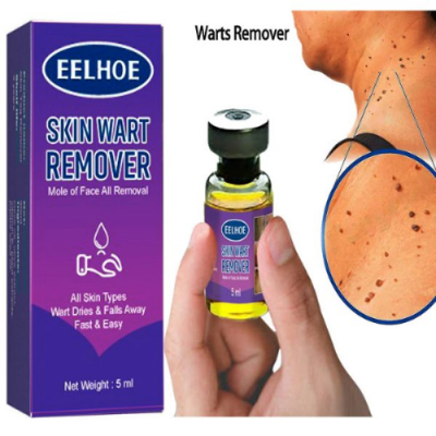 Picture of Skin Tag Remover Wart Remover Skin Tag Removal Quickly and Easily Remove Common Skin Tag Wart and Callus Effective and Scarless Suitable for All Skin Types Deep Care / 5ML / As Shown-NR Mart-2024 - Multicolor