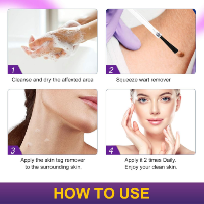 Picture of Skin Tag Remover Wart Remover Skin Tag Removal Quickly and Easily Remove Common Skin Tag Wart and Callus Effective and Scarless Suitable for All Skin Types Deep Care / 5ML / As Shown-NR Mart-2024 - Multicolor