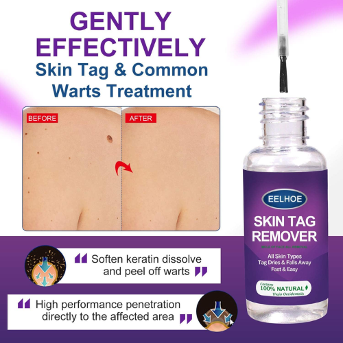 Picture of Skin Tag Remover Wart Remover Skin Tag Removal Quickly and Easily Remove Common Skin Tag Wart and Callus Effective and Scarless Suitable for All Skin Types Deep Care / 5ML / As Shown-NR Mart-2024 - Multicolor