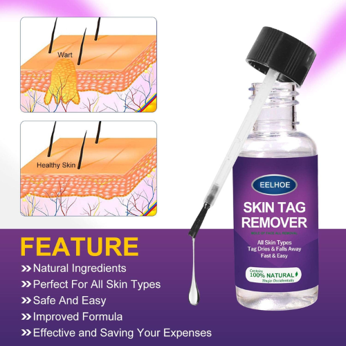Picture of Skin Tag Remover Wart Remover Skin Tag Removal Quickly and Easily Remove Common Skin Tag Wart and Callus Effective and Scarless Suitable for All Skin Types Deep Care / 5ML / As Shown-NR Mart-2024 - Multicolor