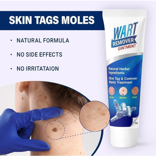 Picture of Warts Remover Ointment Wart Treatment Cream Skin Tag Remover Ointment -  Face - NR Mart-2024