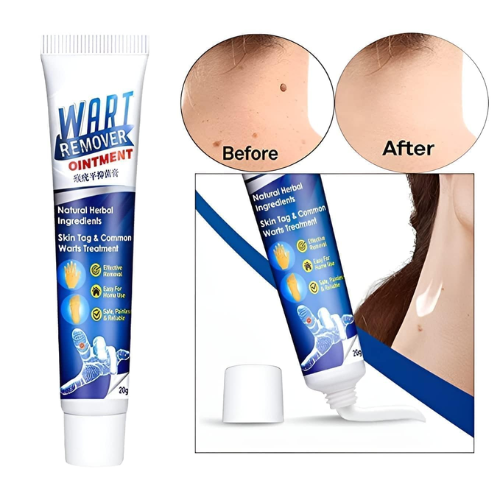 Picture of Warts Remover Ointment Wart Treatment Cream Skin Tag Remover Ointment -  Face - NR Mart-2024