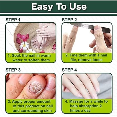 Picture of 1pcs Nail Fungus Repair Gel - Instant Repair Cream for Damaged Nails - Restores the Appearance of Discoloration 