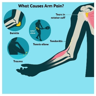 Picture of Arm Immobilizer aluminium & neoprene Brace Elbow Splint Support Stabilizer For Elbow Fracture Wrist Elbow Support For Dislocation, Sprains & Broken Arm(universal size)-healthproo Grey
