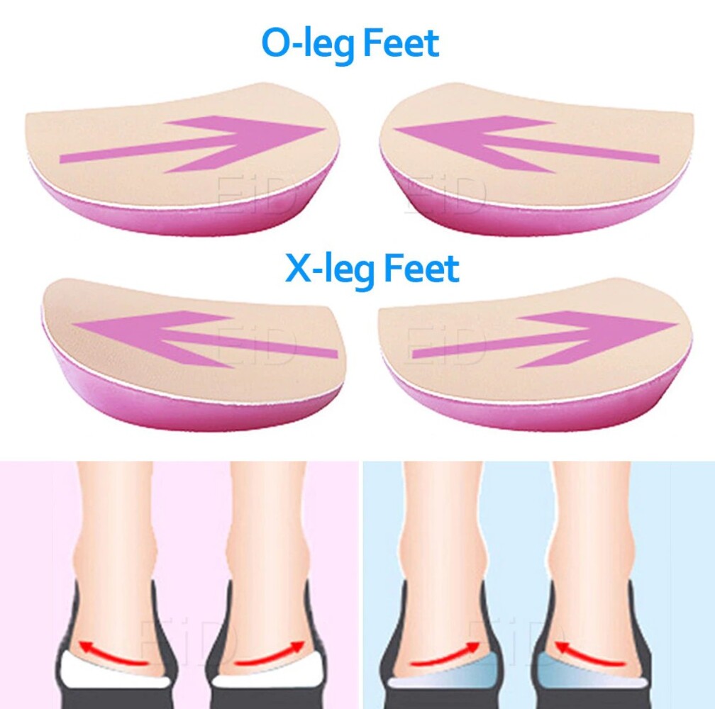 Picture of XO Legs Orthopedic shoes Insoles Silicone Gel Arch Support Pad for Women Flat Foot Orthotic Inserts Pain Relief High Heel Pads Multicolor