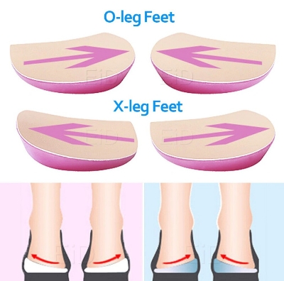 Picture of XO Legs Orthopedic shoes Insoles Silicone Gel Arch Support Pad for Women Flat Foot Orthotic Inserts Pain Relief High Heel Pads Multicolor