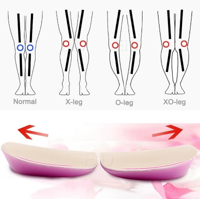 Picture of XO Legs Orthopedic shoes Insoles Silicone Gel Arch Support Pad for Women Flat Foot Orthotic Inserts Pain Relief High Heel Pads Multicolor
