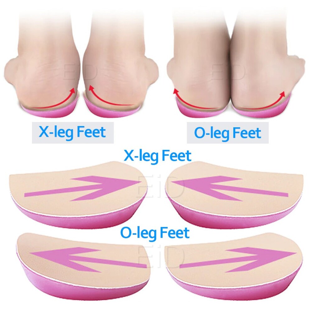 Picture of XO Legs Orthopedic shoes Insoles Silicone Gel Arch Support Pad for Women Flat Foot Orthotic Inserts Pain Relief High Heel Pads Multicolor