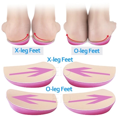 Picture of XO Legs Orthopedic shoes Insoles Silicone Gel Arch Support Pad for Women Flat Foot Orthotic Inserts Pain Relief High Heel Pads Multicolor