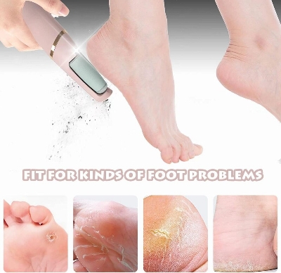 Picture of Callus Remover for Feet | Dead Skin Remover & Pedicure Tool | Electric Foot Callus Remover | Hard Skin Remover | Rechargeable Foot Care Device for Cracked Heels Multicolor