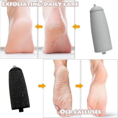 Picture of Pedicure Tool, Foot Callus Remover, Electric Pedicure Set, Foot Care, Removes Rough Dead Skin on The Feet, Making Your Feet Smooth. Multicolor