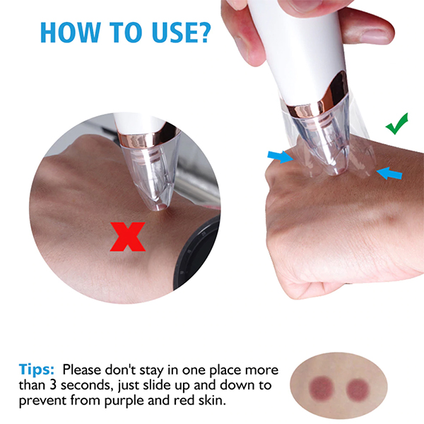 Picture of Rechargeable Device for Remove Blackheads and Whiteheads for Men & Women Multicolor
