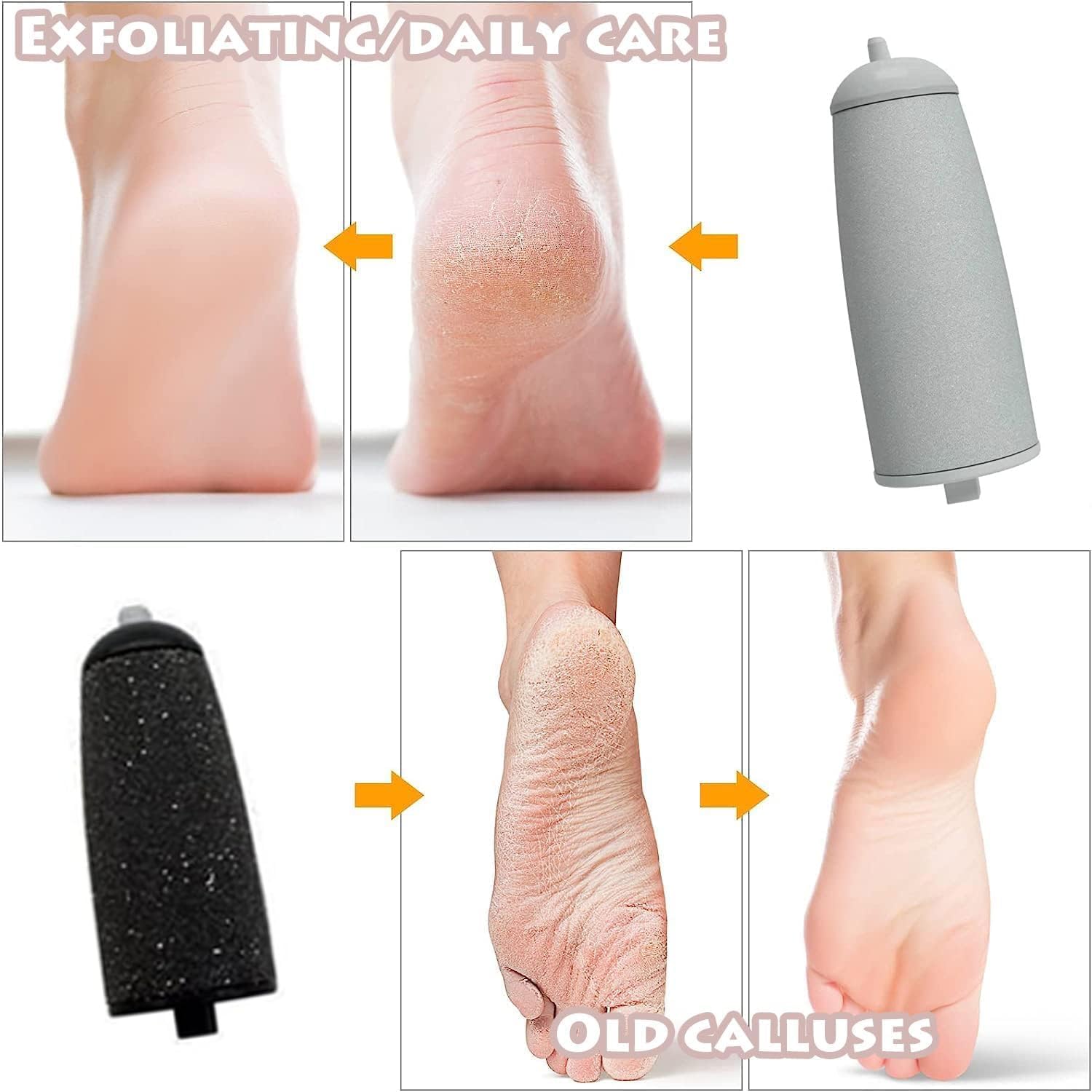 Picture of Pedicure Tool, Foot Callus Remover, Electric Pedicure Set, Foot Care, Removes Rough Dead Skin on The Feet, Making Your Feet Smooth. 