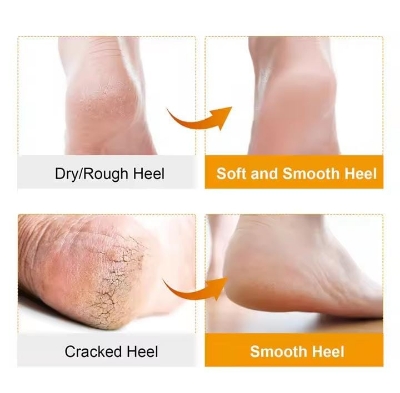 Picture of 2Pcs/Set Soft Silicone Moisturizing Gel Socks For Foot Care Protector Relieve Dry Cracked Peeling Heels Shoes Insole Pedicure 