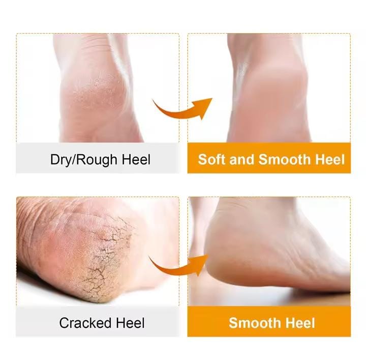 Picture of 2Pcs/Set Soft Silicone Moisturizing Gel Socks For Foot Care Protector Relieve Dry Cracked Peeling Heels Shoes Insole Pedicure Multicolor