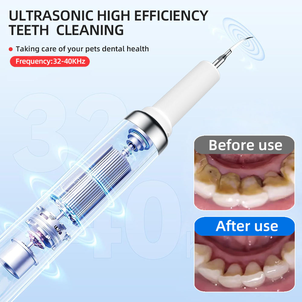 Picture of Plaque Remover for Teeth,Electric Teeth Cleaning Kit with LED Light, Sonic Tooth Cleaner Tartar Remover for Teeth with 3 Adjustable Modes and 2 Replacement Head  USB Rechargeable(White) 