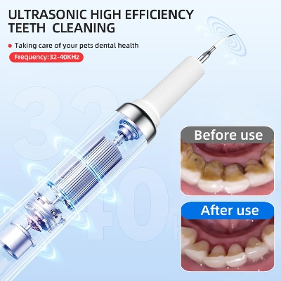 Picture of Plaque Remover for Teeth,Electric Teeth Cleaning Kit with LED Light, Sonic Tooth Cleaner Tartar Remover for Teeth with 3 Adjustable Modes and 2 Replacement Head  USB Rechargeable(White) 