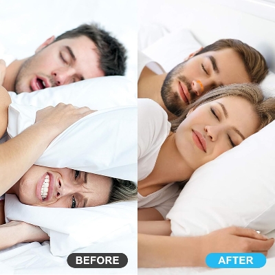 Picture of Magnetic Nasal Strips for Breathing  Anti Snoring Nose Clip  Skin Safe Sleep Nasal Strips  Nasal Dilators For Breathing  Instant Releif From Snoring  Snore Stopper  Anti Snoring Nose Clip  Anti Snoring Devices For Men  15 Count (Pack of 1) Multicolor