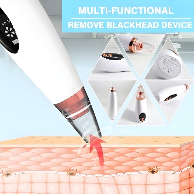 Picture of Blackhead Remover Tool Kit for Teens, Adults, Oily and Sensitive Skin, Electric Pore Vacuum Extractor, Deep Facial Pore Cleaner, Acne Blackhead Removal Device for Nose and Face 