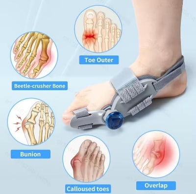Picture of Bunion Corrector for Women Men Big Toe,Adjustable Knob Bunion Corrector for Bunion Relief,Bunion Fix with Bunion Silicone Pad,Suitable for Left and Right Feet(1PCS) ASH