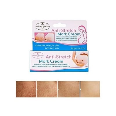 Picture of Radiant Skin Anti-Stretch Mark Miracle Cream 60gm Enriched with Natural Ingredients for Ultimate Skin Renewal-Multicolor