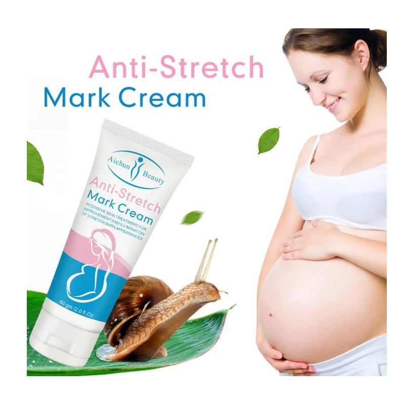 Picture of Radiant Skin Anti-Stretch Mark Miracle Cream 60gm Enriched with Natural Ingredients for Ultimate Skin Renewal-Multicolor