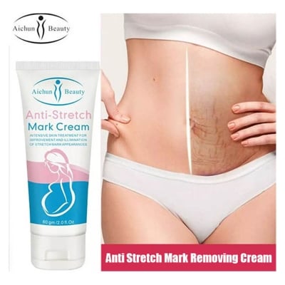 Picture of Radiant Skin Anti-Stretch Mark Miracle Cream 60gm Enriched with Natural Ingredients for Ultimate Skin Renewal-Multicolor