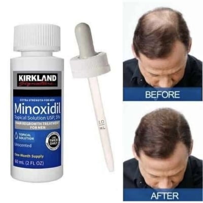 Picture of Kirkland Minoxidil 5% Extra Strength Hair Growth Treatment