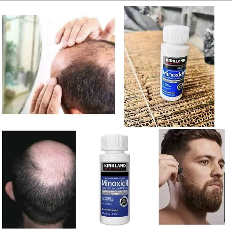 Picture of Kirkland Minoxidil 5% Extra Strength Hair Growth Treatment