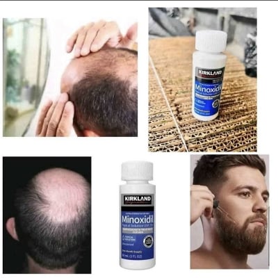 Picture of Kirkland Minoxidil 5% Extra Strength Hair Growth Treatment