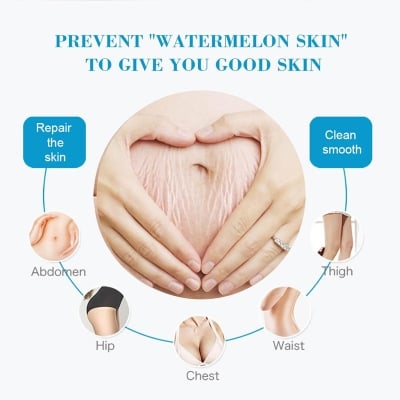 Picture of Aichun Beauty Anti Stretch Mark Cream 60gm Intensive Skin Treatment for Improvement & Elimination