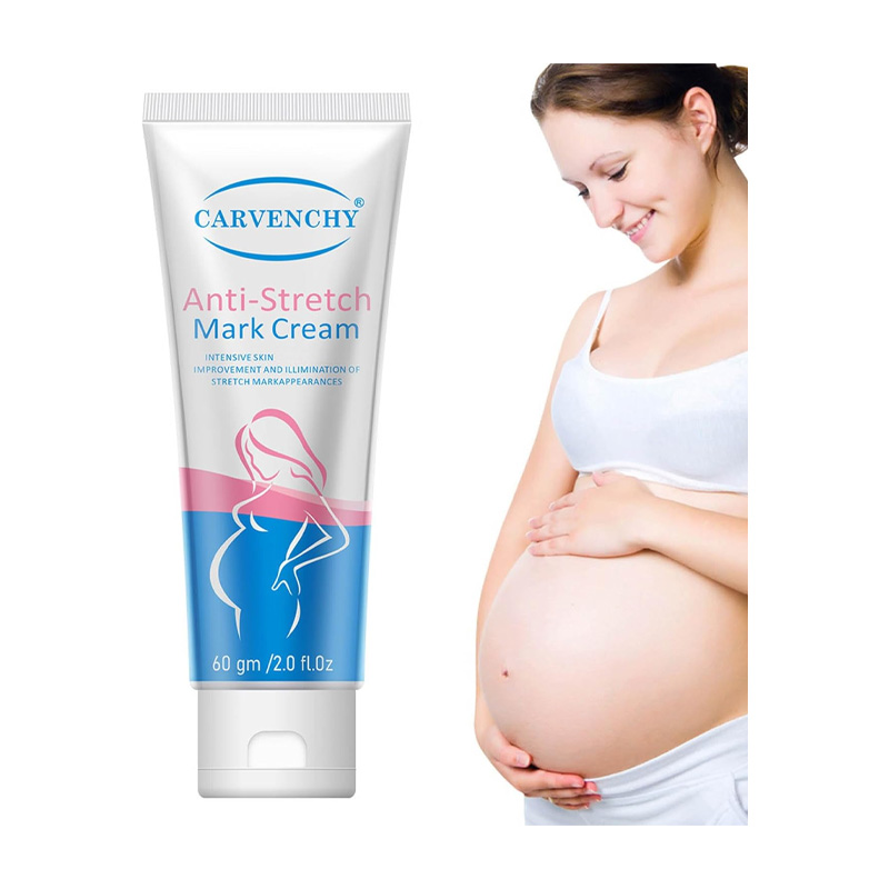 Picture of Aichun Beauty Anti Stretch Mark Cream 60gm Intensive Skin Treatment for Improvement & Elimination