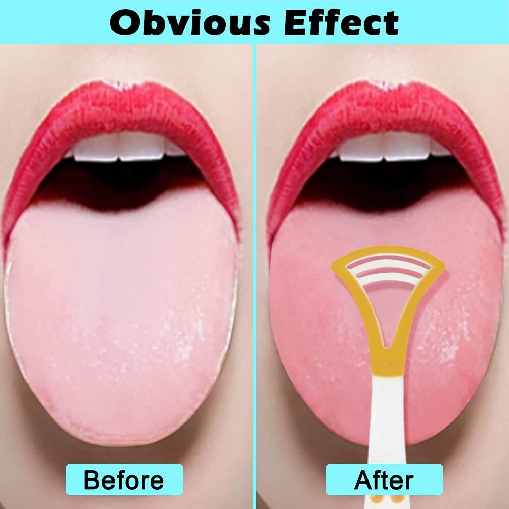Picture of Retail Care 2 PCS COMBO Plastic Tongue Scraper Tongue Cleaner for Children Adults Tongue Scraper Tongue Cleaner for Oral Care Fresh Breath Comfortable & Safe