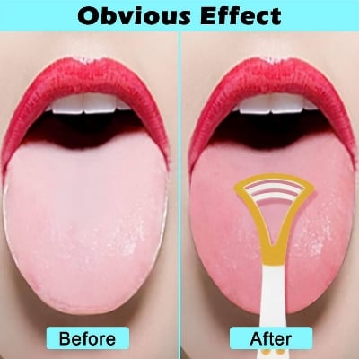 Picture of Retail Care 2 PCS COMBO Plastic Tongue Scraper Tongue Cleaner for Children Adults Tongue Scraper Tongue Cleaner for Oral Care Fresh Breath Comfortable & Safe