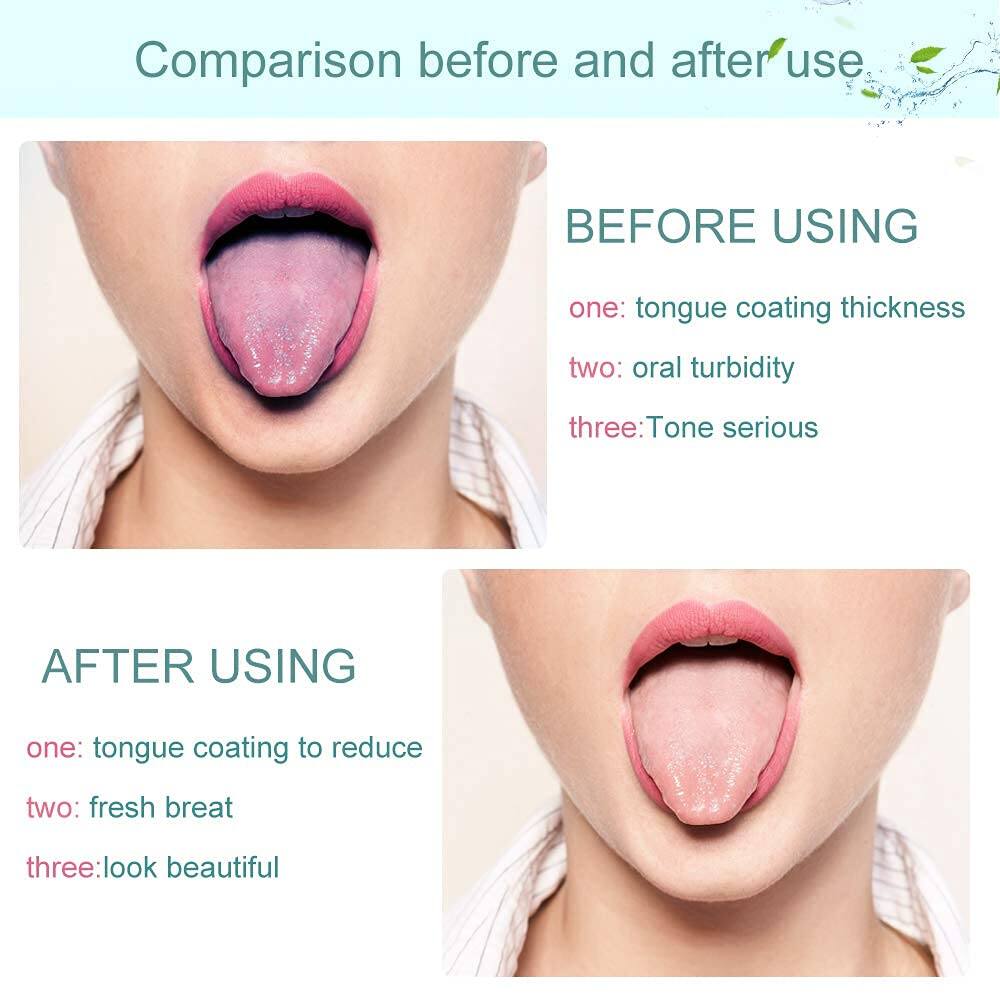 Picture of Tongue Scraper Silicone Brush Cleaning Food Oral Care To Keep Fresh Breath tongue scraper and mouth wash1pcs