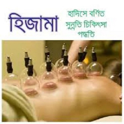 Picture of Hijama set/ cupping set/ Massage Cupping/ Dry cupping set 12pcs Blue