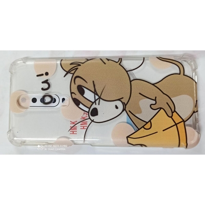 Picture of Ip X/Xs /10 Soft Phone Case. - Camera - Phone Back Cover 