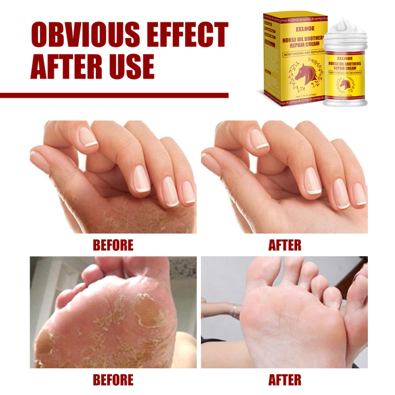 Picture of EELHOE Horse Oil Brother Skin Repair Cream-50gm (Relief from cracked feet)